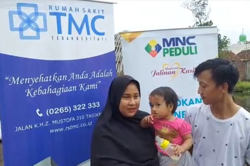 MNC Peduli dan RS TMC Tasikmalaya Gelar Operasi Bibir Sumbing Gratis